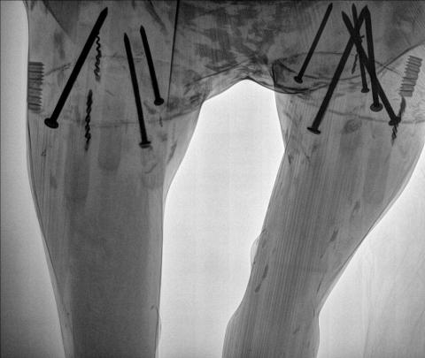 Looking sturdy! An X-ray of Riley’s legs show his legs are super reinforced.